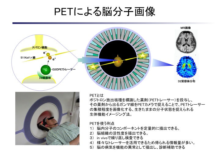 PET