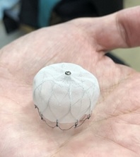 20240718　最新医療の提供（ウォッチマン）経皮的左心耳閉鎖術　デバイス　循内.jpg
