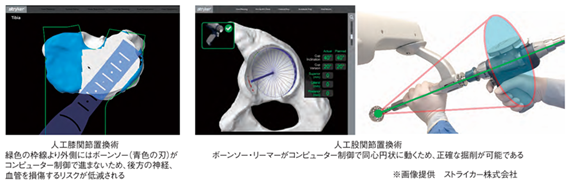 20260731　整形　ｍｖ1　Mako図②.png