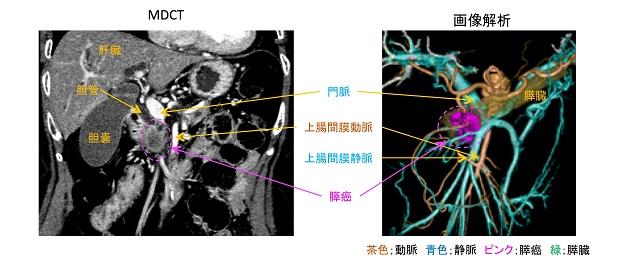 画像解析