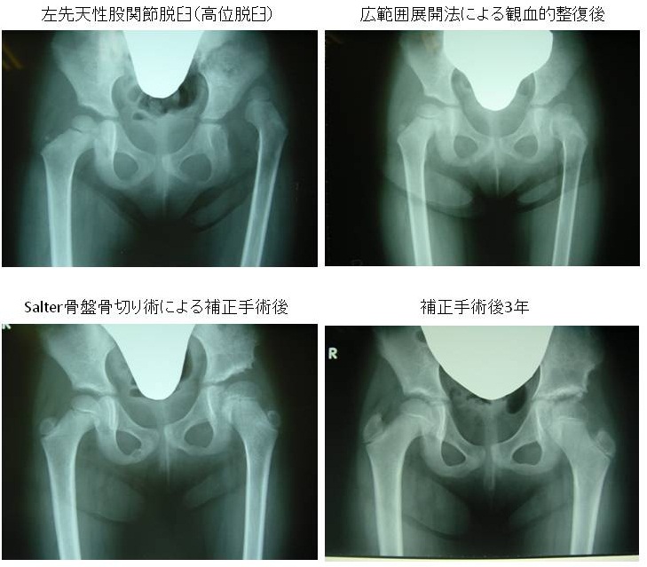 CT画像4枚