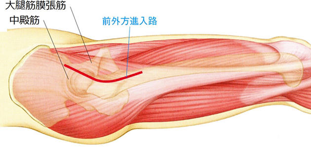 図4 前外側筋間進入
